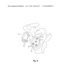 PERIPHERAL PEG DRILL COMPONENT diagram and image