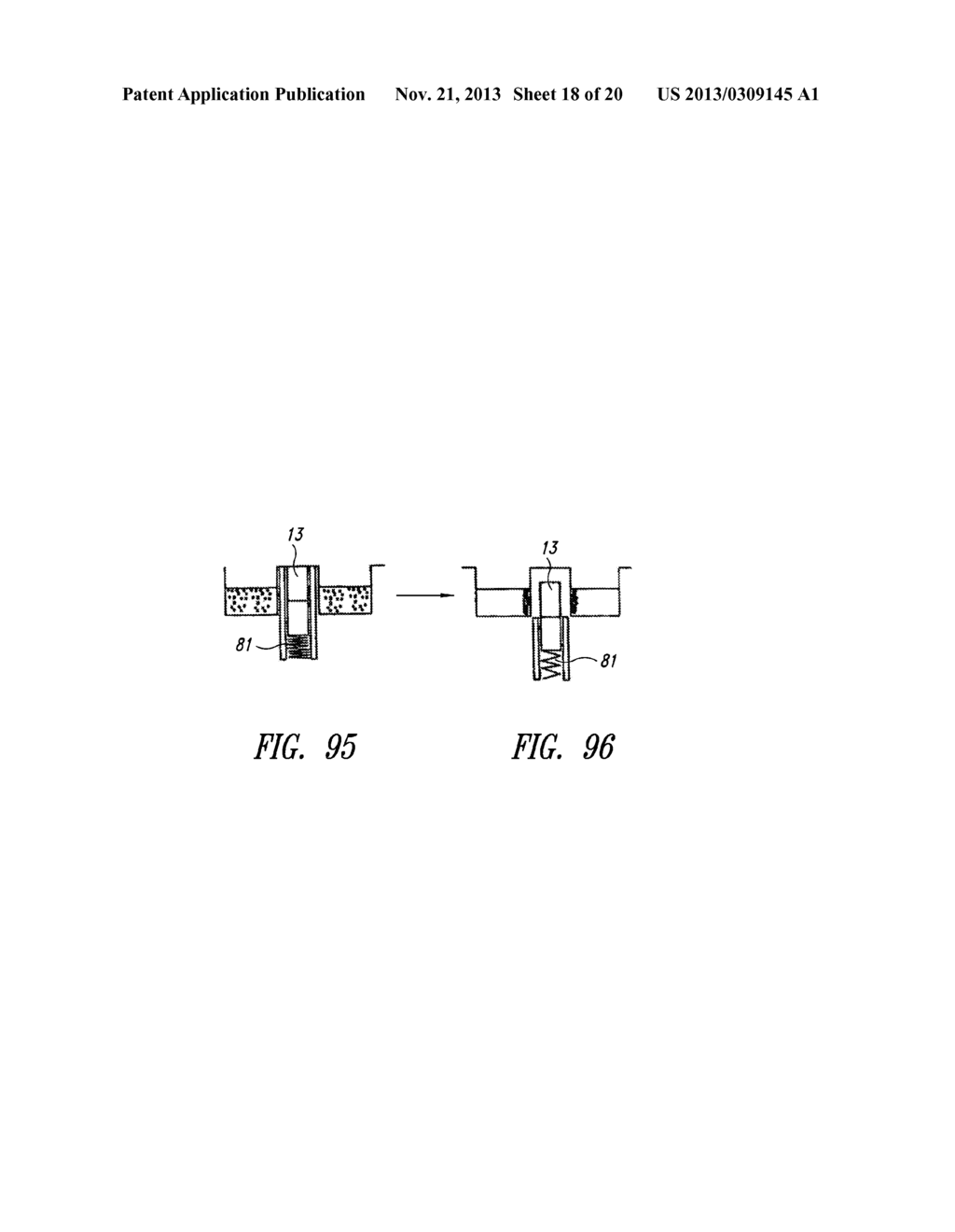 METHOD AND A DEVICE FOR TREATING MICROPARTICLES - diagram, schematic, and image 19