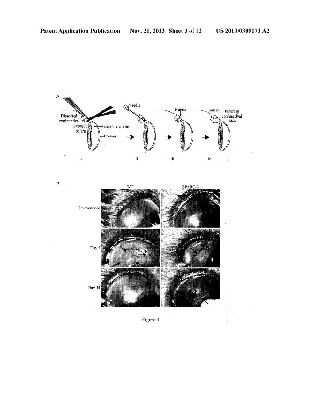 METHODS AND COMPOSITIONS FOR MAINTENANCE OF A FUNCTIONAL WOUND - diagram, schematic, and image 04