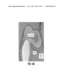 CONFORMAL PARTICLE COATINGS ON FIBROUS MATERIALS diagram and image