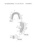 Orthodontic Bracket System Having an Archwire Channel and Archwire     Retaining Mechanism diagram and image