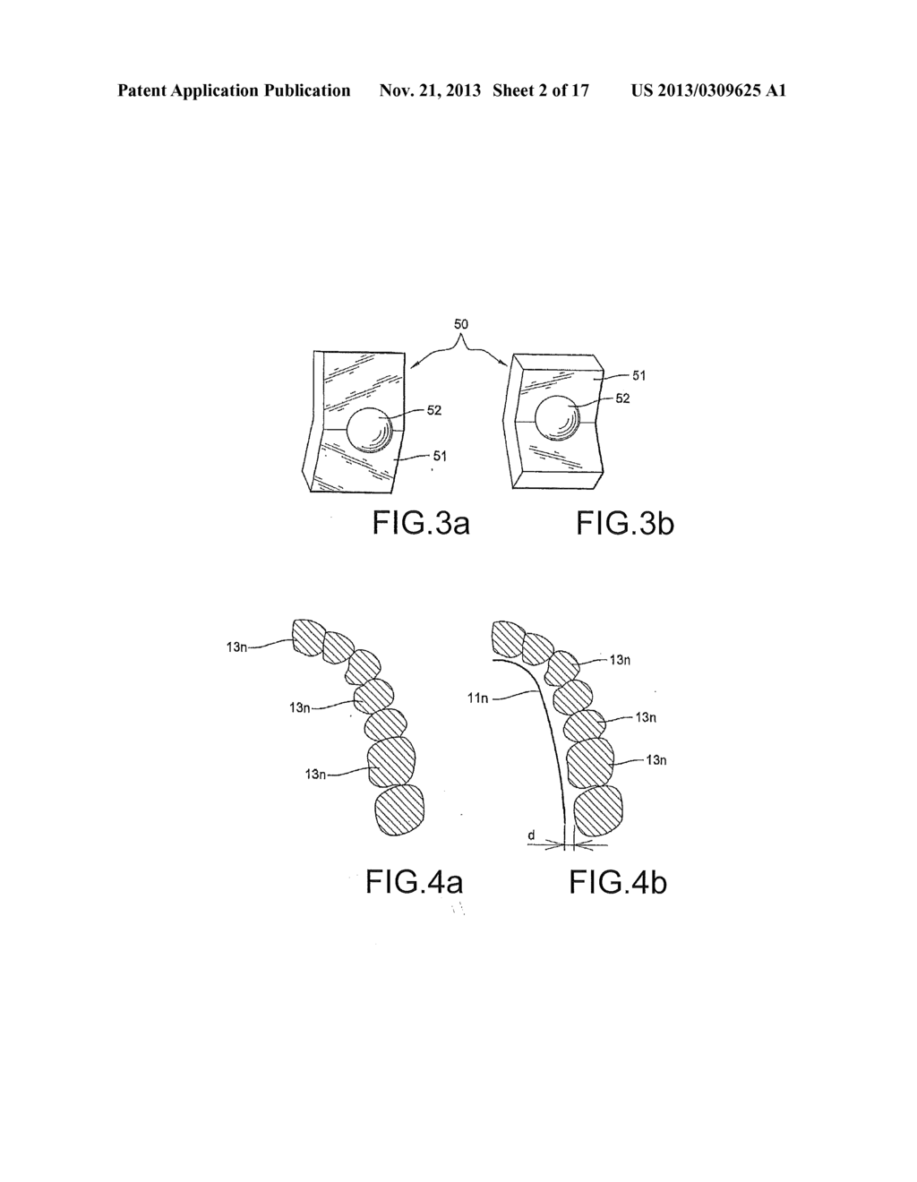 Orthodontic Bracket System Having an Archwire Channel and Archwire     Retaining Mechanism - diagram, schematic, and image 03