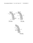 Orthodontic Bracket System Having an Archwire Channel and Archwire     Retaining Mechanism diagram and image