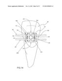 Orthodontic Bracket System Having an Archwire Channel and Archwire     Retaining Mechanism diagram and image