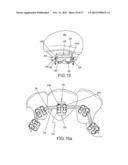 Orthodontic Bracket System Having an Archwire Channel and Archwire     Retaining Mechanism diagram and image