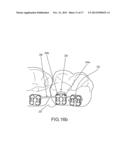 Orthodontic Bracket System Having an Archwire Channel and Archwire     Retaining Mechanism diagram and image