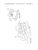 Orthodontic Bracket System Having an Archwire Channel and Archwire     Retaining Mechanism diagram and image