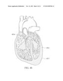 SELECTIVE 3D BIOPATTERNING diagram and image