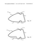 HOLLOW GOLF CLUB HEAD HAVING SOLE STRESS REDUCING FEATURE diagram and image