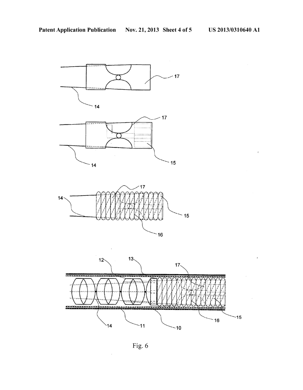 FLEXIBLE GASTROINTESTINAL VIDEOENDOSCOPE - diagram, schematic, and image 05