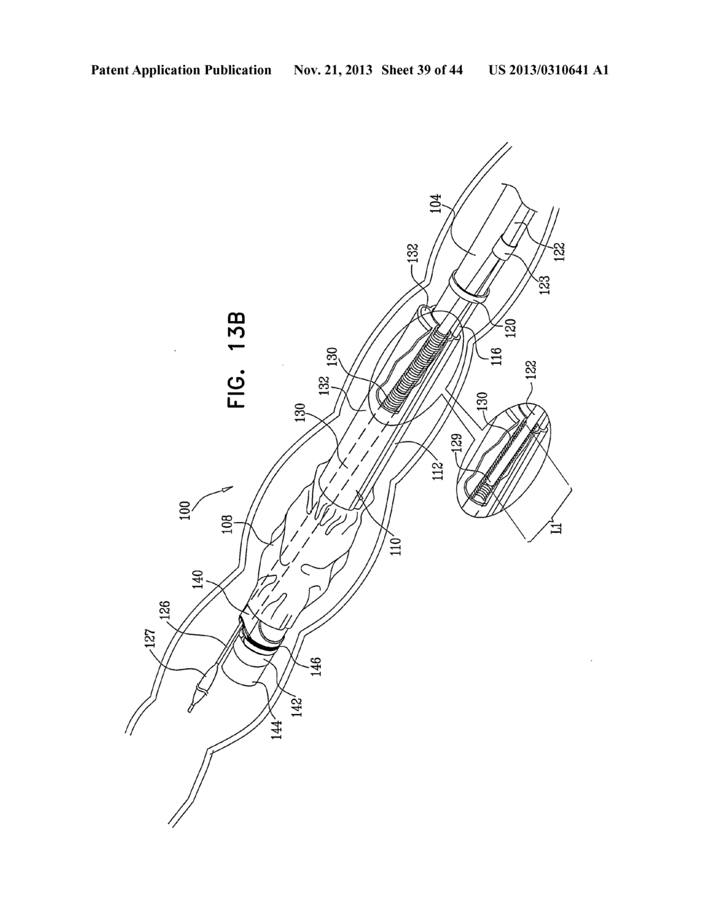 FLEXIBLE ENDOSCOPE SYSTEM AND FUNCTIONALITY - diagram, schematic, and image 40