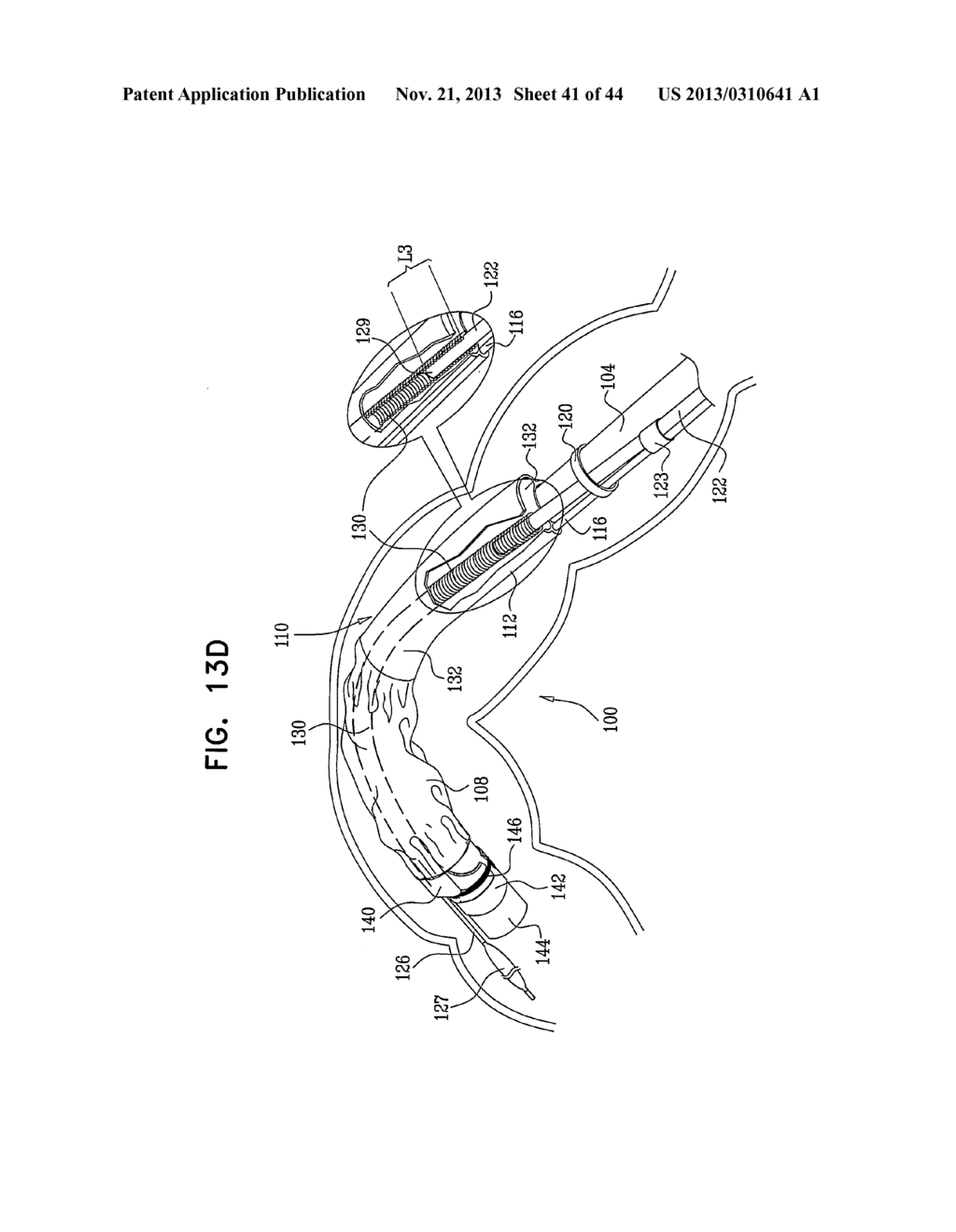 FLEXIBLE ENDOSCOPE SYSTEM AND FUNCTIONALITY - diagram, schematic, and image 42