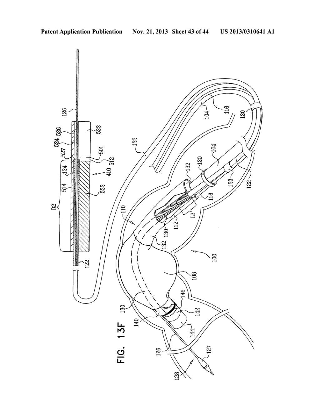 FLEXIBLE ENDOSCOPE SYSTEM AND FUNCTIONALITY - diagram, schematic, and image 44