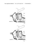 LARYNGOSCOPY diagram and image