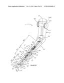 LARYNGOSCOPY diagram and image