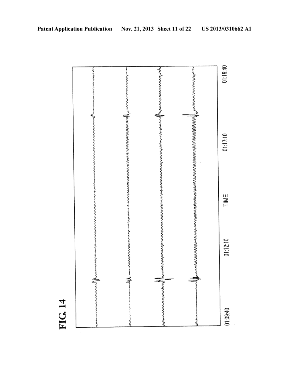 SLEEP EVALUATION DEVICE AND SLEEP EVALUATION METHOD - diagram, schematic, and image 12