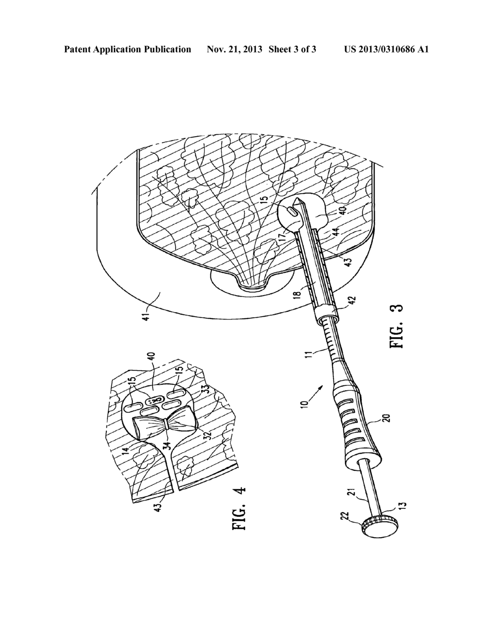 FIBROUS MARKER AND INTRACORPOREAL DELIVERY THEREOF - diagram, schematic, and image 04