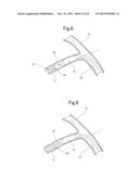 BLOOD VESSEL EMBOLIZATION METHOD USING BALLOON CATHETER AND BALLOON     CATHETER FOR BLOOD VESSEL EMBOLIZATION METHOD diagram and image