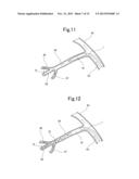 BLOOD VESSEL EMBOLIZATION METHOD USING BALLOON CATHETER AND BALLOON     CATHETER FOR BLOOD VESSEL EMBOLIZATION METHOD diagram and image