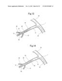 BLOOD VESSEL EMBOLIZATION METHOD USING BALLOON CATHETER AND BALLOON     CATHETER FOR BLOOD VESSEL EMBOLIZATION METHOD diagram and image