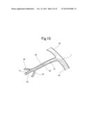 BLOOD VESSEL EMBOLIZATION METHOD USING BALLOON CATHETER AND BALLOON     CATHETER FOR BLOOD VESSEL EMBOLIZATION METHOD diagram and image