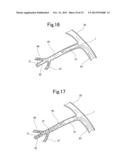 BLOOD VESSEL EMBOLIZATION METHOD USING BALLOON CATHETER AND BALLOON     CATHETER FOR BLOOD VESSEL EMBOLIZATION METHOD diagram and image