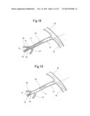 BLOOD VESSEL EMBOLIZATION METHOD USING BALLOON CATHETER AND BALLOON     CATHETER FOR BLOOD VESSEL EMBOLIZATION METHOD diagram and image