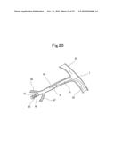 BLOOD VESSEL EMBOLIZATION METHOD USING BALLOON CATHETER AND BALLOON     CATHETER FOR BLOOD VESSEL EMBOLIZATION METHOD diagram and image