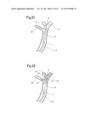 BLOOD VESSEL EMBOLIZATION METHOD USING BALLOON CATHETER AND BALLOON     CATHETER FOR BLOOD VESSEL EMBOLIZATION METHOD diagram and image