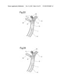 BLOOD VESSEL EMBOLIZATION METHOD USING BALLOON CATHETER AND BALLOON     CATHETER FOR BLOOD VESSEL EMBOLIZATION METHOD diagram and image