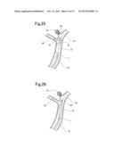 BLOOD VESSEL EMBOLIZATION METHOD USING BALLOON CATHETER AND BALLOON     CATHETER FOR BLOOD VESSEL EMBOLIZATION METHOD diagram and image