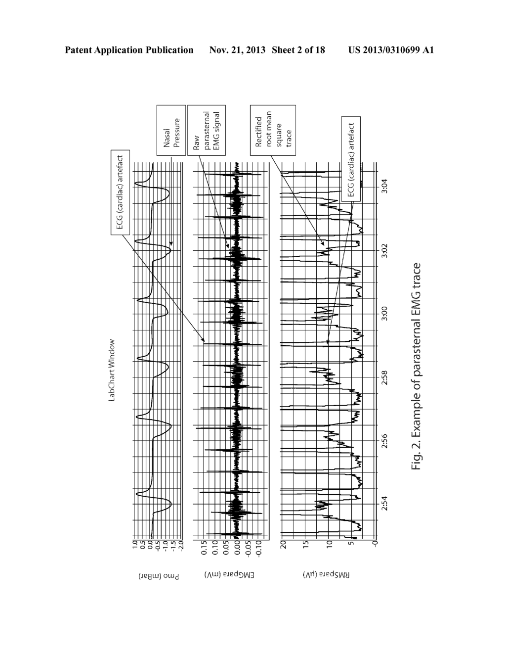 Patient Monitoring Method and Monitoring Device - diagram, schematic, and image 03