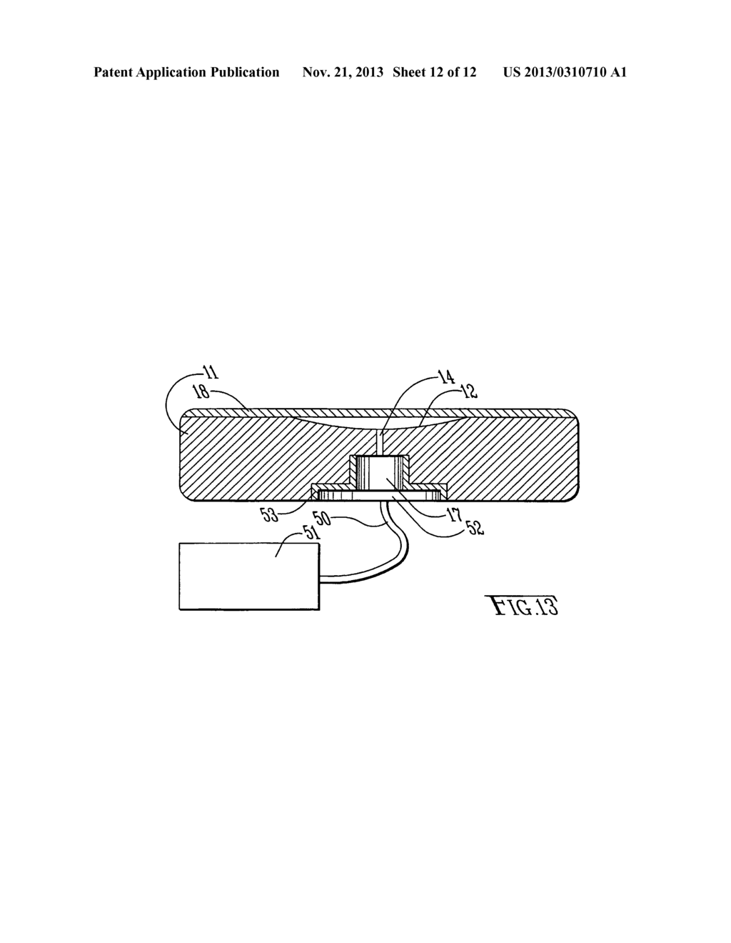 Pneumatic Tocodynamometer - diagram, schematic, and image 13