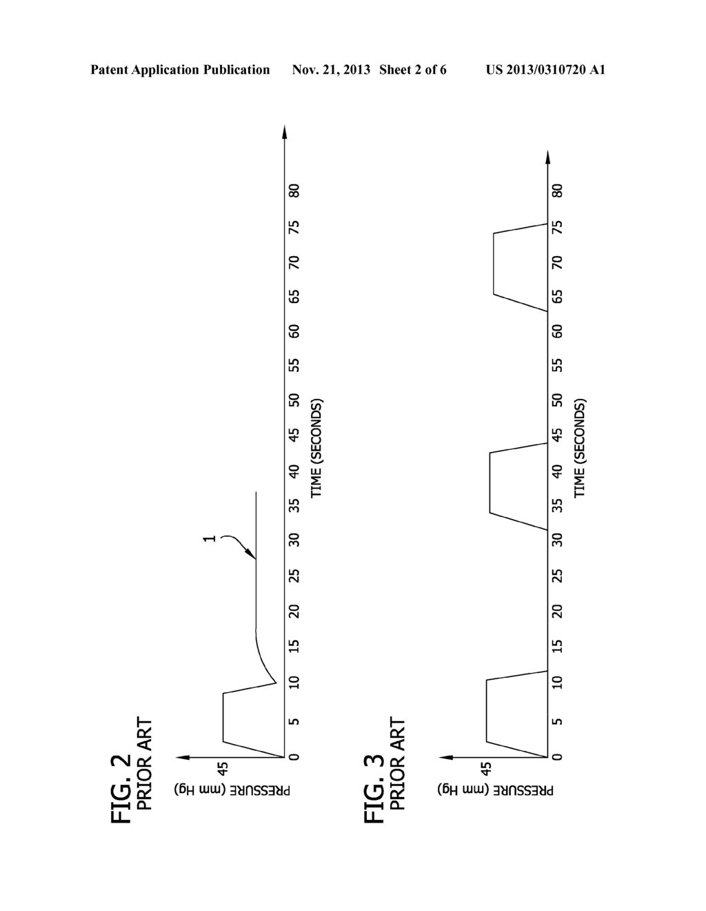 Venous Augmentation System - diagram, schematic, and image 03