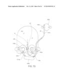 Dressing for an Insertion Site of an Intravascular Infusate diagram and image