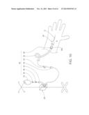 Dressing for an Insertion Site of an Intravascular Infusate diagram and image