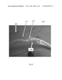 MEDICAL CONDUIT PROTECTION DEVICES, SYSTEMS AND METHODS diagram and image