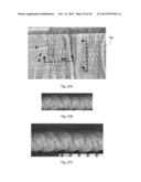 ABSORBENT ARTICLES HAVING TEXTURED ZONES diagram and image