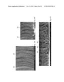 ABSORBENT ARTICLES HAVING TEXTURED ZONES diagram and image