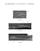 ABSORBENT ARTICLES HAVING TEXTURED ZONES diagram and image