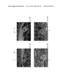 ABSORBENT ARTICLES HAVING TEXTURED ZONES diagram and image