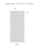 ABSORBENT ARTICLES HAVING TEXTURED ZONES diagram and image