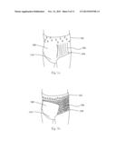 Absorbent Article Having Multiple Graphic Zones diagram and image