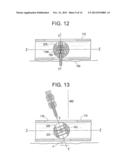 SYSTEMS, DEVICES AND METHODS FOR FLUID/DRUG DELIVERY diagram and image