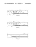 Clot Removal Device and Method of Using Same diagram and image