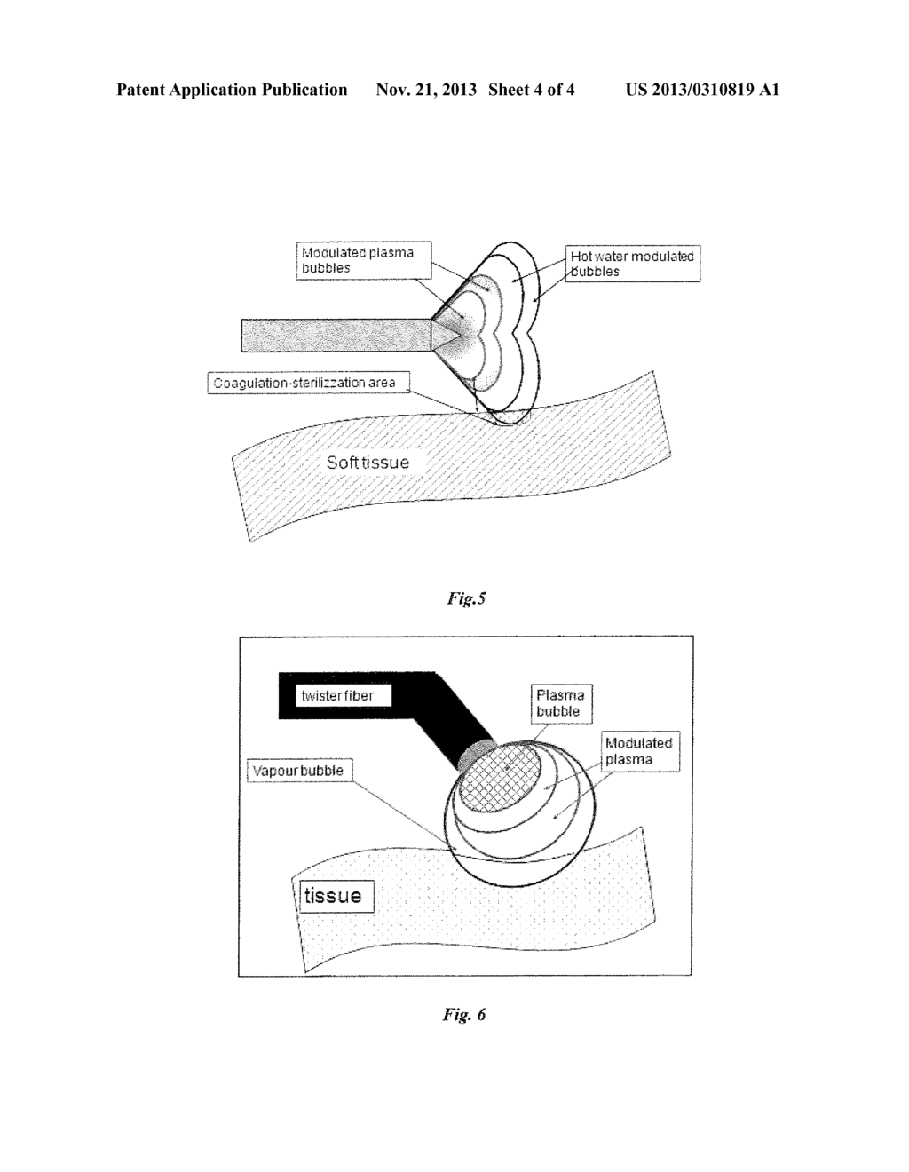 LASER PLASMA MODULATOR SYSTEM FOR ENDOSCOPY AND ENDOCAVITARY SURGERY - diagram, schematic, and image 05