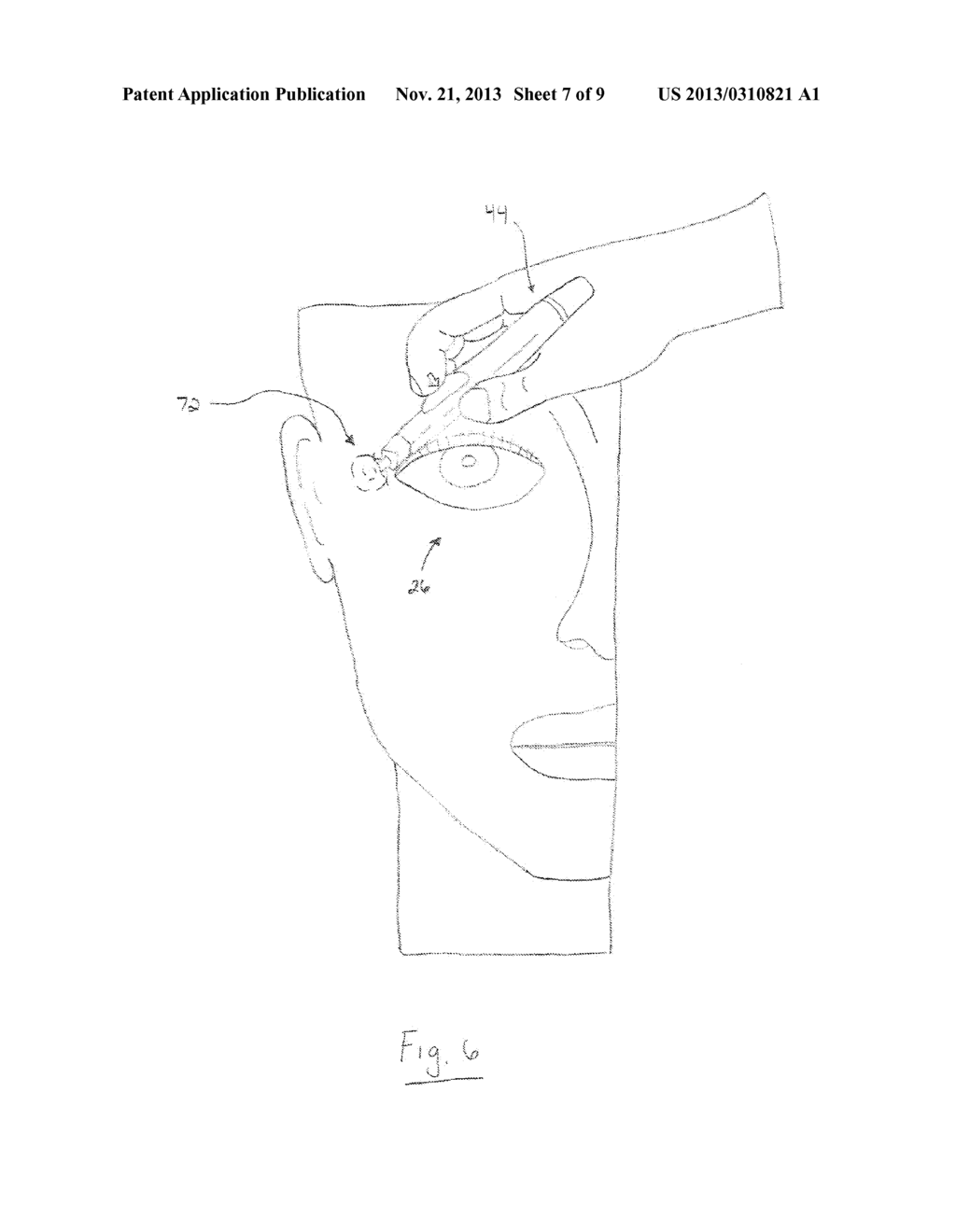 APPARATUS AND METHOD FOR TREATING A NEUROMUSCULAR DEFECT - diagram, schematic, and image 08