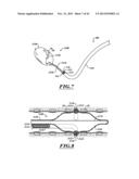 COMPACT DELIVERY PULMONARY TREATMENT SYSTEMS AND METHODS FOR IMPROVING     PULMONARY FUNCTION diagram and image