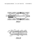 COMPACT DELIVERY PULMONARY TREATMENT SYSTEMS AND METHODS FOR IMPROVING     PULMONARY FUNCTION diagram and image