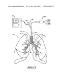 COMPACT DELIVERY PULMONARY TREATMENT SYSTEMS AND METHODS FOR IMPROVING     PULMONARY FUNCTION diagram and image
